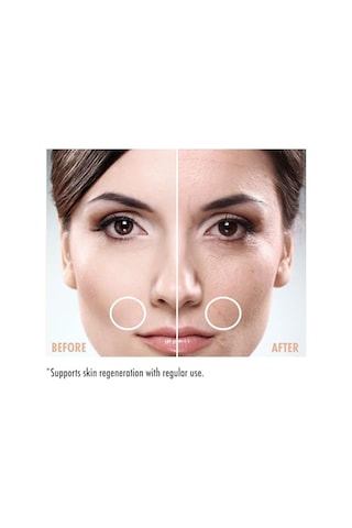 Maruderm Retinol%0.3 Su Bazlı Cilt Yenileyici Bakım Serumu Bakuchiol, Q10 & Yeşil Çay İle İnce Çizgi Karşıtı, Aydınlatıcı Yüz Serumu, 30 Ml
