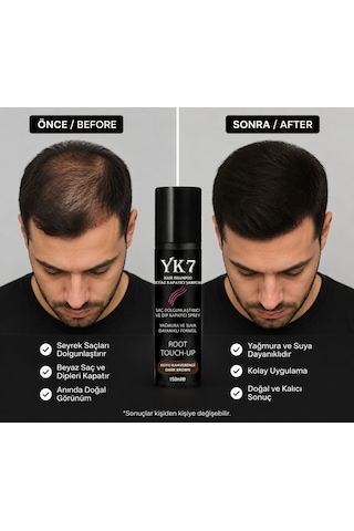 Yk7 Siyah /black Saç Dolgunlaştırıcı Ve Dip Kapatıcı Topik Sprey 150 Ml.