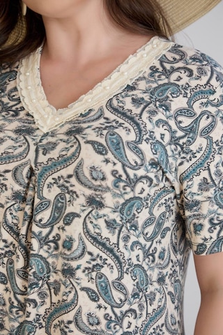 Wearon Kadın Beliz Büyük Beden Dantelli Kısa Kollu Turkuaz Elbise Bej