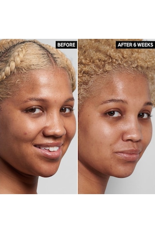 The Inkey List Niacinamide Serum 30 ML