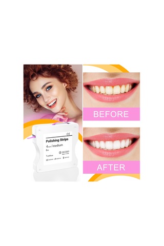 Suofeng Diş Parlatma Şeritleri - 6 Metre Renkli Ve Yüzey Taşlama İçin