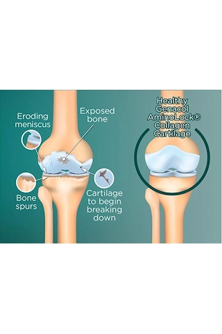 Genacol Plus Glucosamine Collagen 90 Kapsül