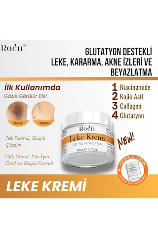Roen Kararma Ve Akne Lekeleri Glutatyon İçeren Leke Kremi 50 ML