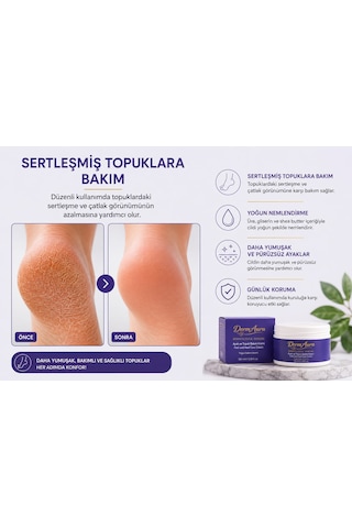 Dermaura Urealı Yoğun Nemlendirici Ayak Ve Topuk Bakım Kremi 100 Ml
