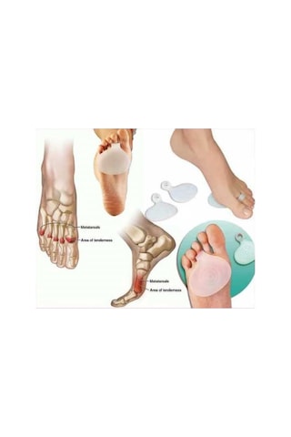 Silikon Metatarsal Ped Ayak Altı Ağrı Nasır Koruma Parmağa Halka