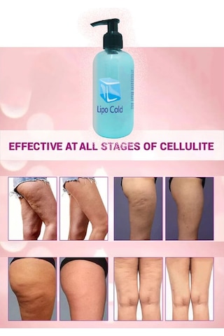 Lipo Cold Fazlalaşan Yağlarınızdan Ve Selülitlerinizden Kurtulmaya Karşı Krem 250 Ml