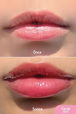 Parlatıcı, Dolgunlaştırıcı, Onarıcı Vegan Dudak Balmı, Tatlı Şeker Aromalı 10 Ml