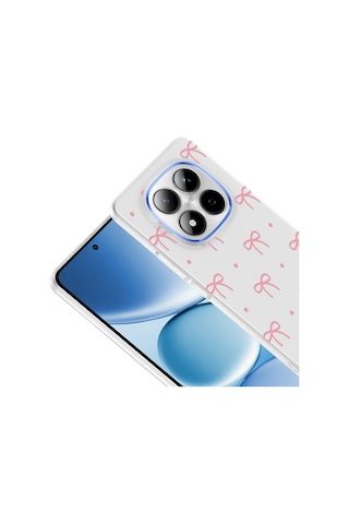 Redmi Note 15 Pro 4g Kılıf Kamera Korumalı Desenli Klip Kılıf Fiyonk