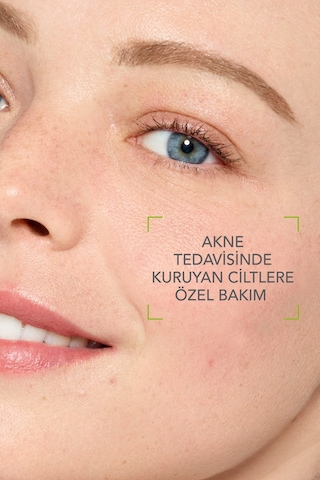 Nemlendirici Dudak Kremi & Akneye Eğilim Gösteren, Kuruyan Hassas Ciltler Yatıştırıcı Bakım Kremi - 696929406