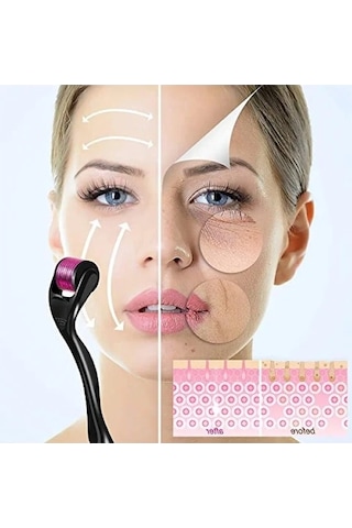 Derma Roller - 1.0mm, 540 Mikro İğne