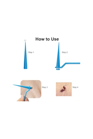 Teltree "ağrısız 2'li Et Beni Çıkarma Seti - 2mm-8mm Boyutlar İçin Lastik Bantlı" Çok Renkli
