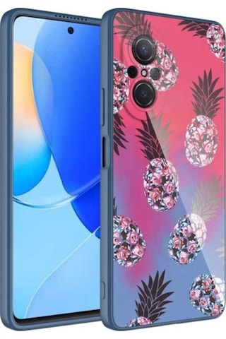 Huawei Nova 9 Se Kılıf Kamera Korumalı Desenli Sert Silikon Zore Epoksi Kapak NO3