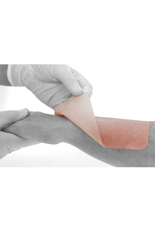 Advasil Conform 10Cm x 15Cm Silikon Jel Tabaka Skar – Keloid