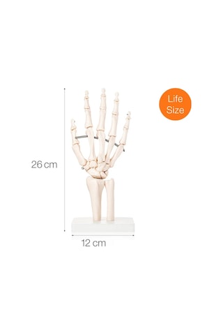 El Eklemi Modeli