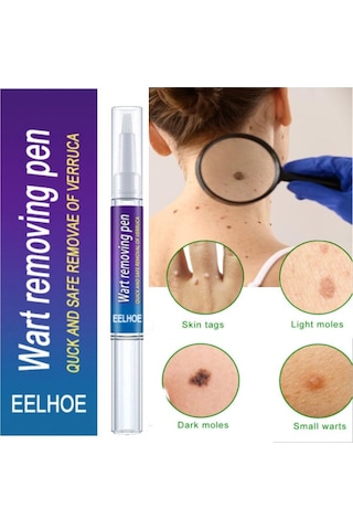 Cilt Etiketi Sökücü Benlere Karşı Tıbbi Ağrısız Hızlı Kaldırma Genital Siğil Akne Leke Tedavisi Papillomlar Düz Siğil Güzellik Sağlık