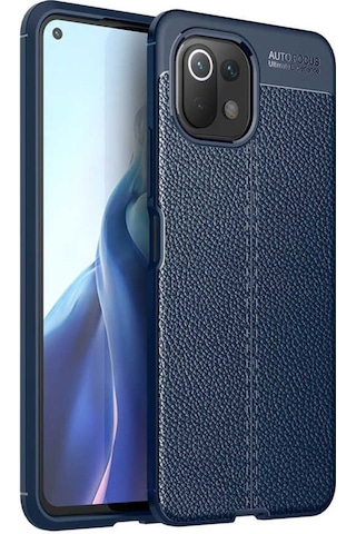 Xiaomi Mi 11 Lite Kılıf Zore Niss Deri Desenli Silikon Kılıf