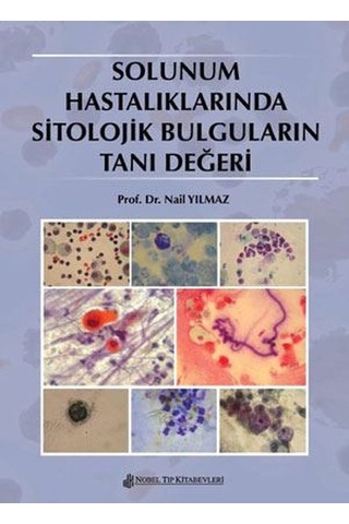 Solunum Hastalıklarında Sitolojik Bulguların Tanı Değeri- Nobel Tıp Kitabevleri Solunum Hastalıklarında Sitolojik Bulguların Tanı Değeri- Nobel Tıp Kitabevleri