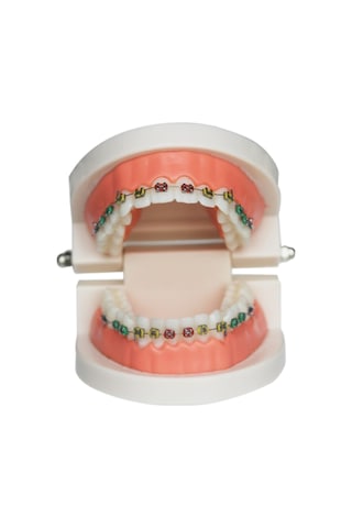 Wezone Diş Hekimi Eğitimi İçin Gerçekçi Simülasyon Aletleri - Çeşitli Renk Seçenekli Paslanmaz Çelik Sahte Braketler