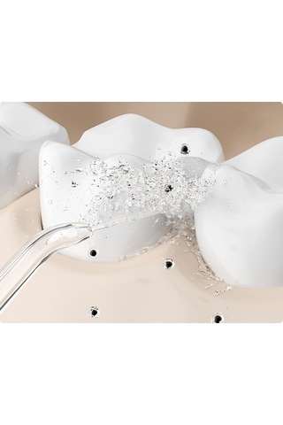 Lichen Ortodontik Temizlik Özel Ev Tipi Su İpi, Su İpi Su