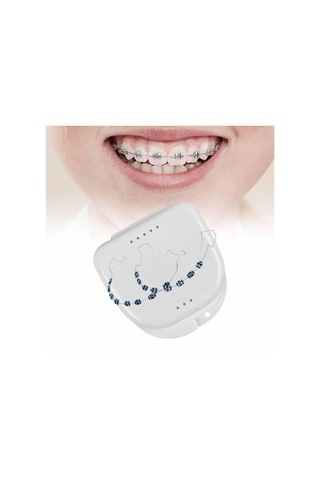 Suntek Kutu Ortodontisti Ile Geçici Diş Dekorasyonu Destekleri