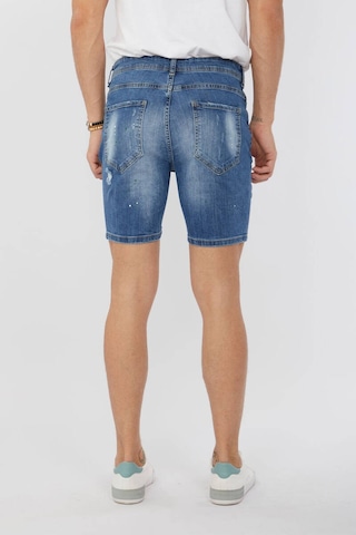 Markapia Erkek Boyalı Jean Kısa Şort Mavi 001