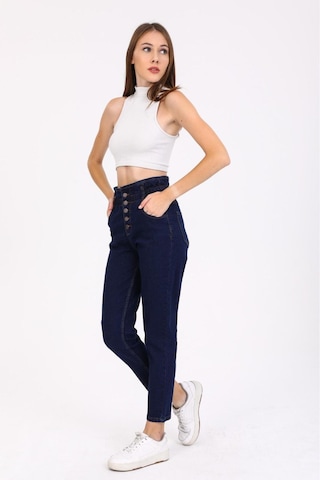 Kene Jeans Kadın Lacivert Patlet Düğmeli Kemer Büzgülü Mom Kot Pantolon Lacivert