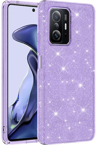 Xiaomi Uyumlu Mi 11t 5g Kılıf Zore Parıltılı Simli Shining Silikon