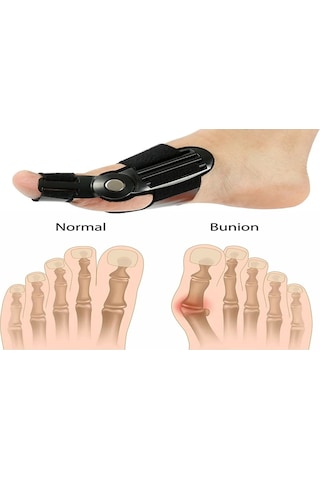 Benlife Makaralı Baş Parmak Kemik Düzeltici