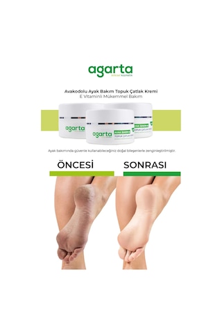 Agarta Ayak Ve Topuk Çatlak Bakım Kremi 100ml