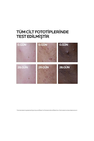 La Roche Posay Effaclar Duo + Cilt Kusuru Görünümü Karşıtı Akneye Eğilim Gösteren Ciltler İçin Bakım Kremi 40 Ml 2 Adet