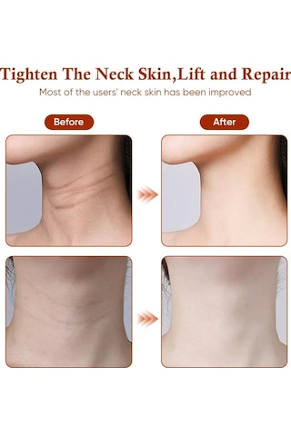 Jl Boyun Güzellik Cihazı Ems Mikro-akım Yüz Cilt Bakımı Masaj