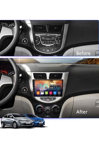NAKAMİCHİ Hyundai ACCENT BLUE 4 Gb+ 64 Gb Android Multimedya Carplay + Android Auto