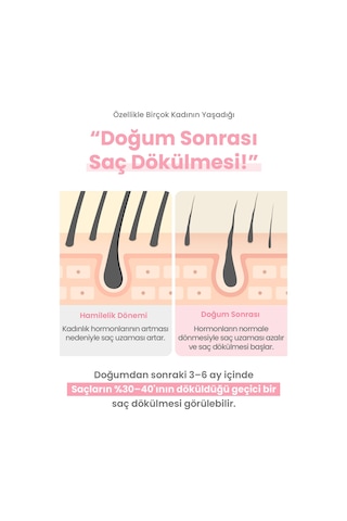 Hamileler İçin Silikonsuz Dökülme Karşıtı Saç Kremi Atopalm Maternity Care Scalp Therapy Treatment