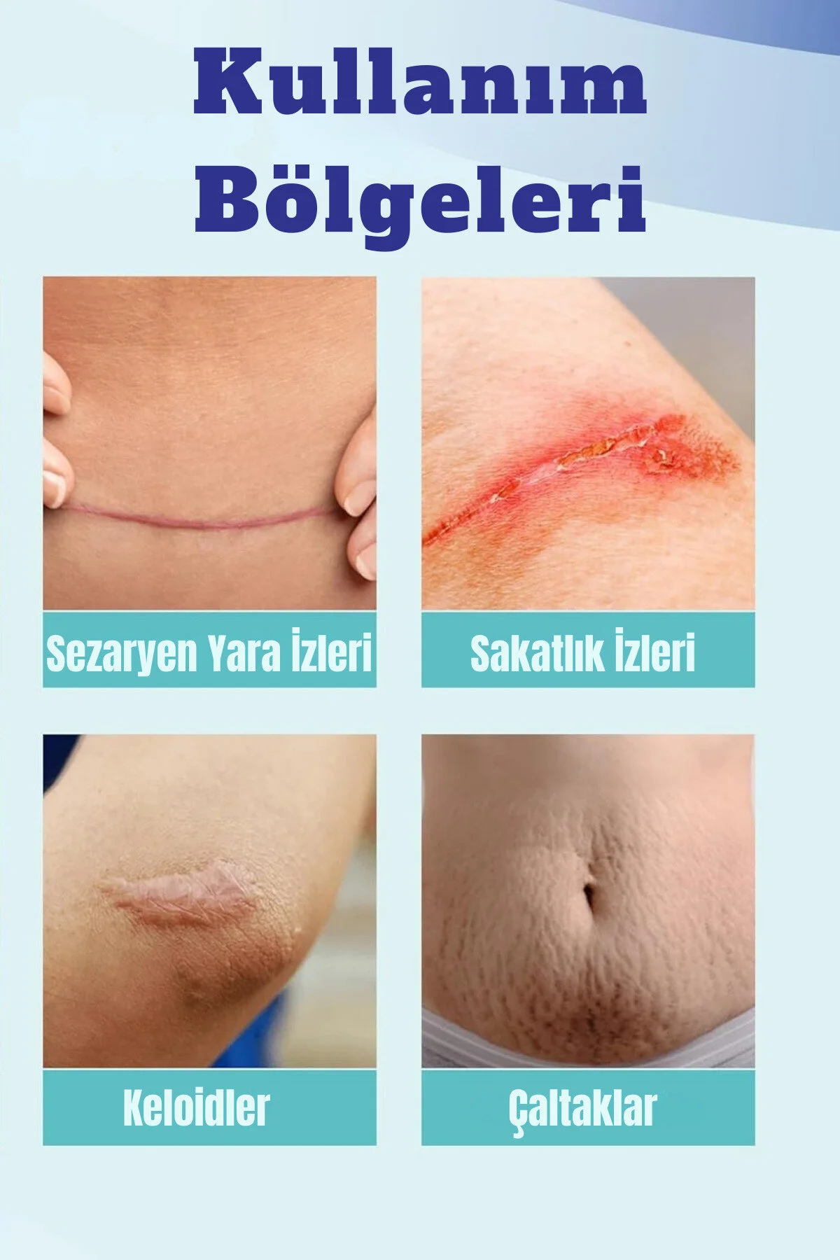 Aroamas Silikon Yara Jeli 30 ML