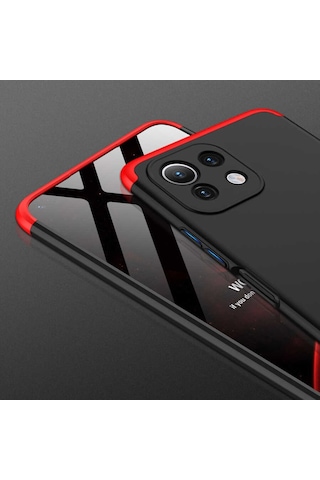 Xiaomi Mi 11 Lite Kilif Zore Kamera Korumali 360 Tam Koruma Ays 496999698
