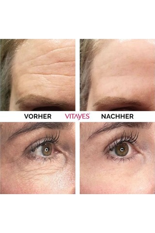 Vitayes Instant Ageback Anında Etkili Yüz Germe Kremi 15 ML