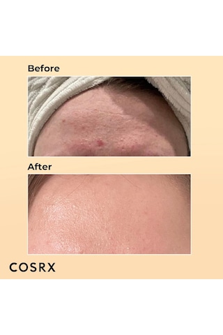 Cosrx Advanced Snail 96 Mucin Power Essence 100 ML