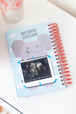 Bebek Anı Defteri Erkek Stickerlı + Çekim Ve Zeka Kartları Seti