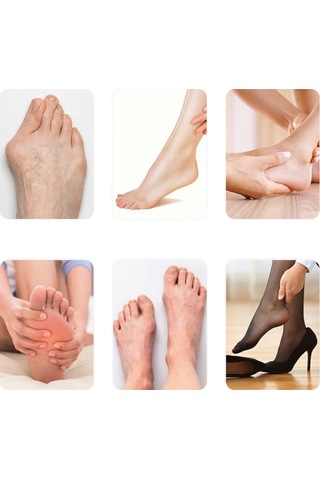 Akestoria Med Ayarlanabilir Cırtlı Baş Parmak Kemik Sönger Düzeltici Fc-053 Standart