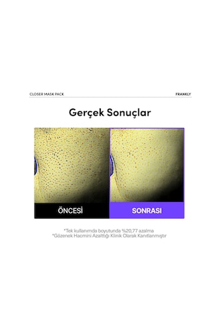 Frankly Pirinç Özü Peptit Ve Kolajen İçeren Gözenek Sıkılaştırıcı Kağıt Maske 22 ML