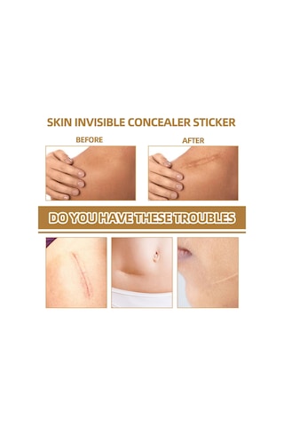 Hangfox 60 Adet Silikon Gizleme Yama Seti - Doğal Görünüm, Nefes Alıcı - Yara Izleri, Doğuş Lekeleri Ve Benekler İçin Uygun