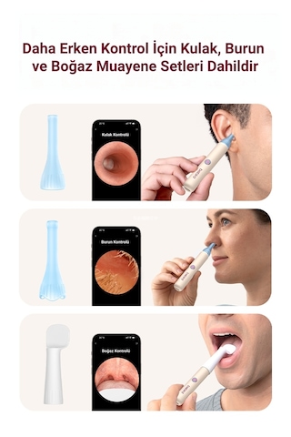 Bebird Earsight 3 Pro Hd Kameralı Akıllı Kulak Temizleme Cihazı