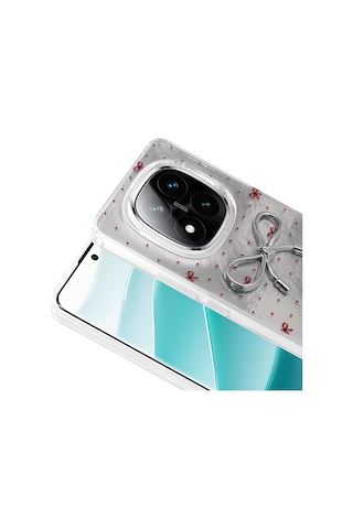 Xiaomi Redmi Note 14 Pro 5g Kılıf Kamera Korumalı Figürlü Zore Ponti Silikon Kapak Açık Mavi