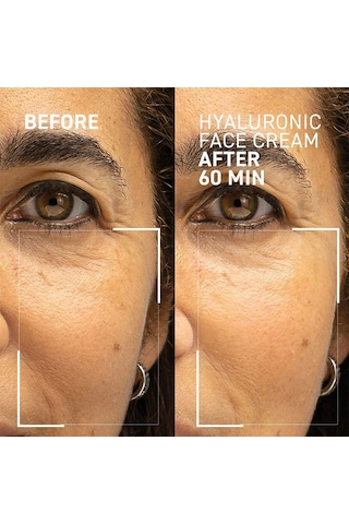Dr.brandt Needles No More Hyaluronic Face Cream 50ml Cilt Bakım Kremi