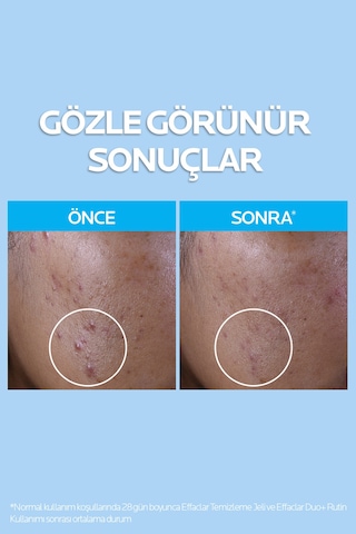 Effaclar Jel Yağlı, /sivilceye Eğilimli Ciltler Için Yüz Temizleme Jeli 400mlx2