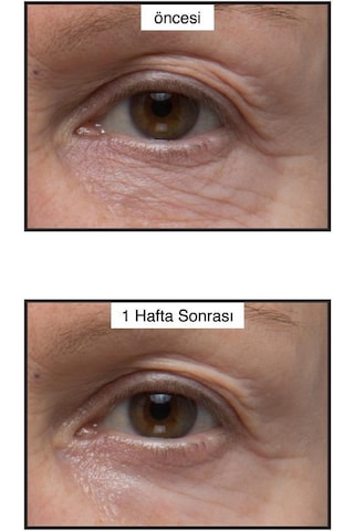 Murad Renewing Eye 15 ml Kırışık Göz Çevresi Kremi