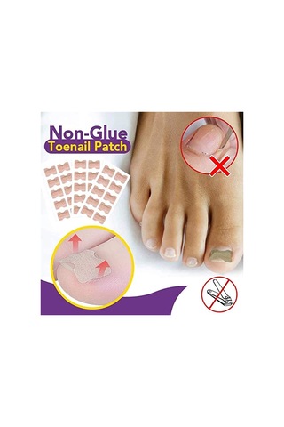 Wezone Nefes Alabilen Tırnak Düzeltme Yapışkanları - 10 Adet 100 Yapışkan, Batık Tırnak Tedavisi İçin Pratik Çözüm