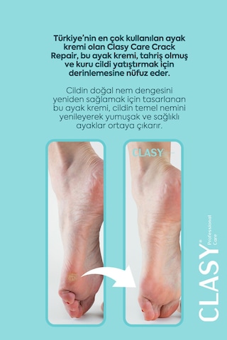 Ayak Ve Topuk Çatlak Kremi, Ayak Bakımı, Ayak Kokusu Ve Topuk 100ml