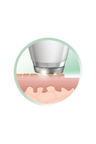 Remington Mikrodermabrazyon Reveal Diamond Md3000 - Sıkı, Parlak,