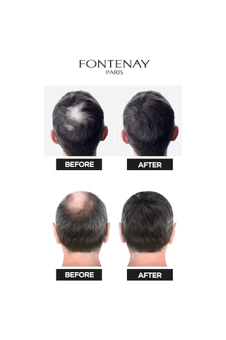 Fontenay Topik Keratin Fıbers Siyah